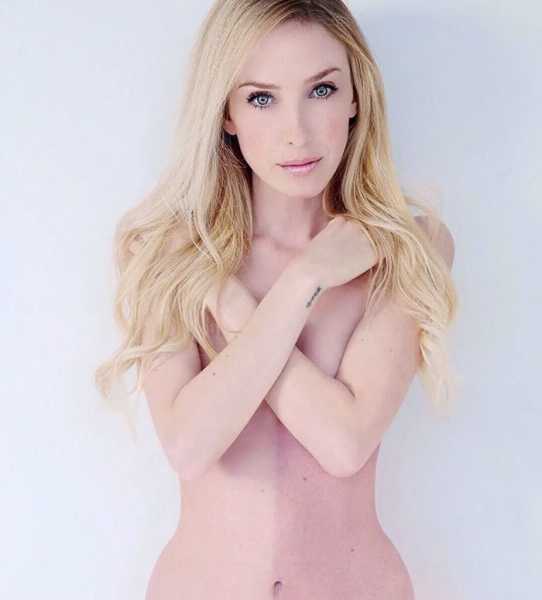 На этих фото показали, какие финты генетика вытворяет с людьми