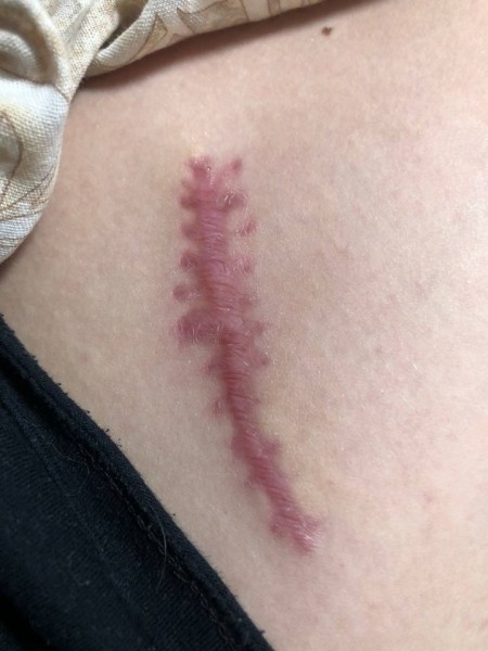 «Как итог — у меня изувечена нога». Девушка пошла на квест и получила травму