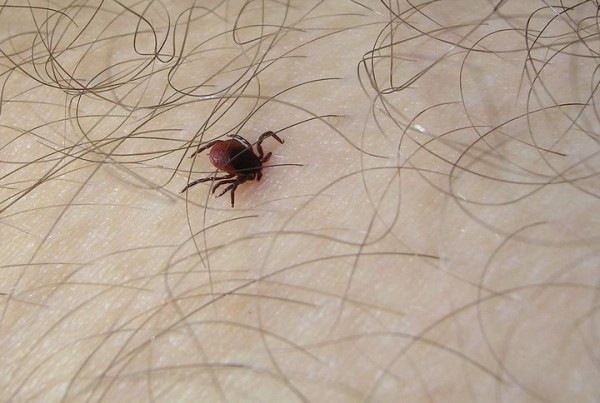 За 5 месяцев на Брестчине более 550 человек обратились к медикам из-за укусов клещей. Алгоритм действий при укусе клеща